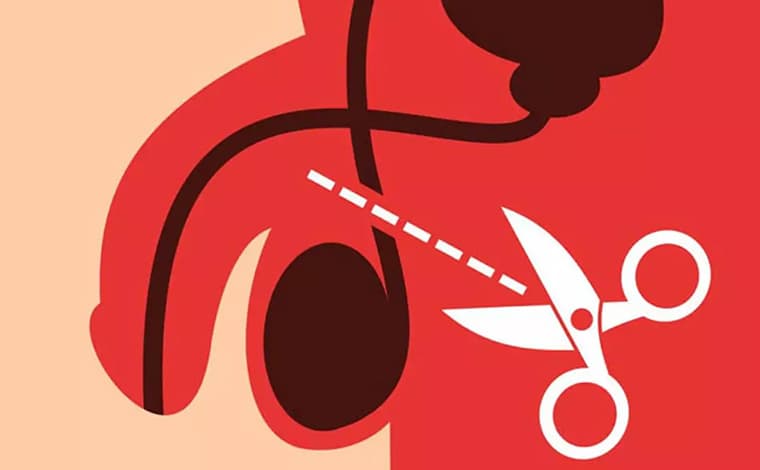 Vasectomía y reversión de vasectomía